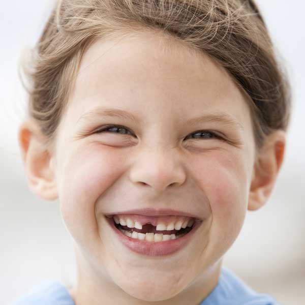 child with knocked out tooth